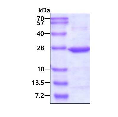 SDS-PAGE: Recombinant Human SAR1 His Protein [NBP1-30177]